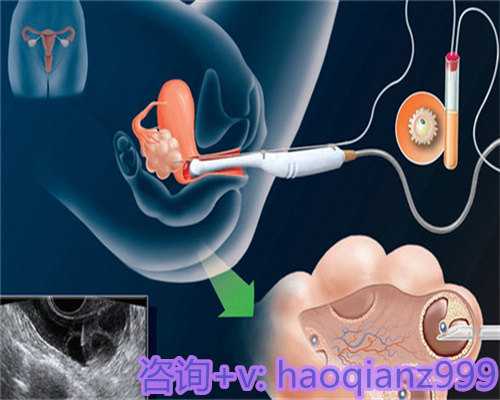 2024最新北京供卵三代试管医院包生男孩公布！内附助孕费用及成功率参考